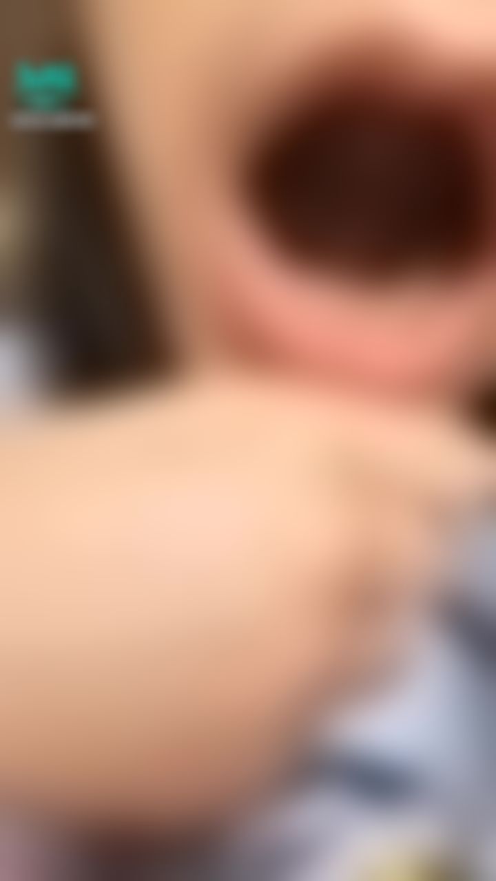  : 舌頭好痛喔🙁