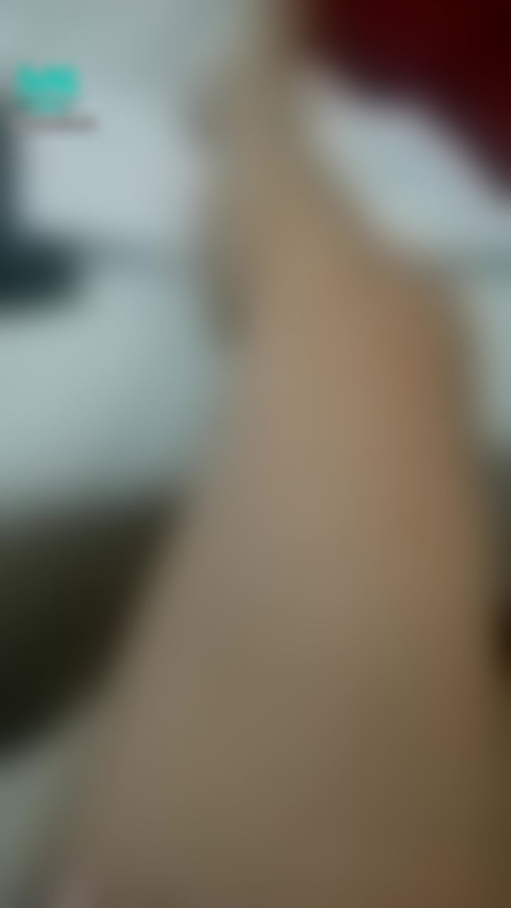 : tease legs