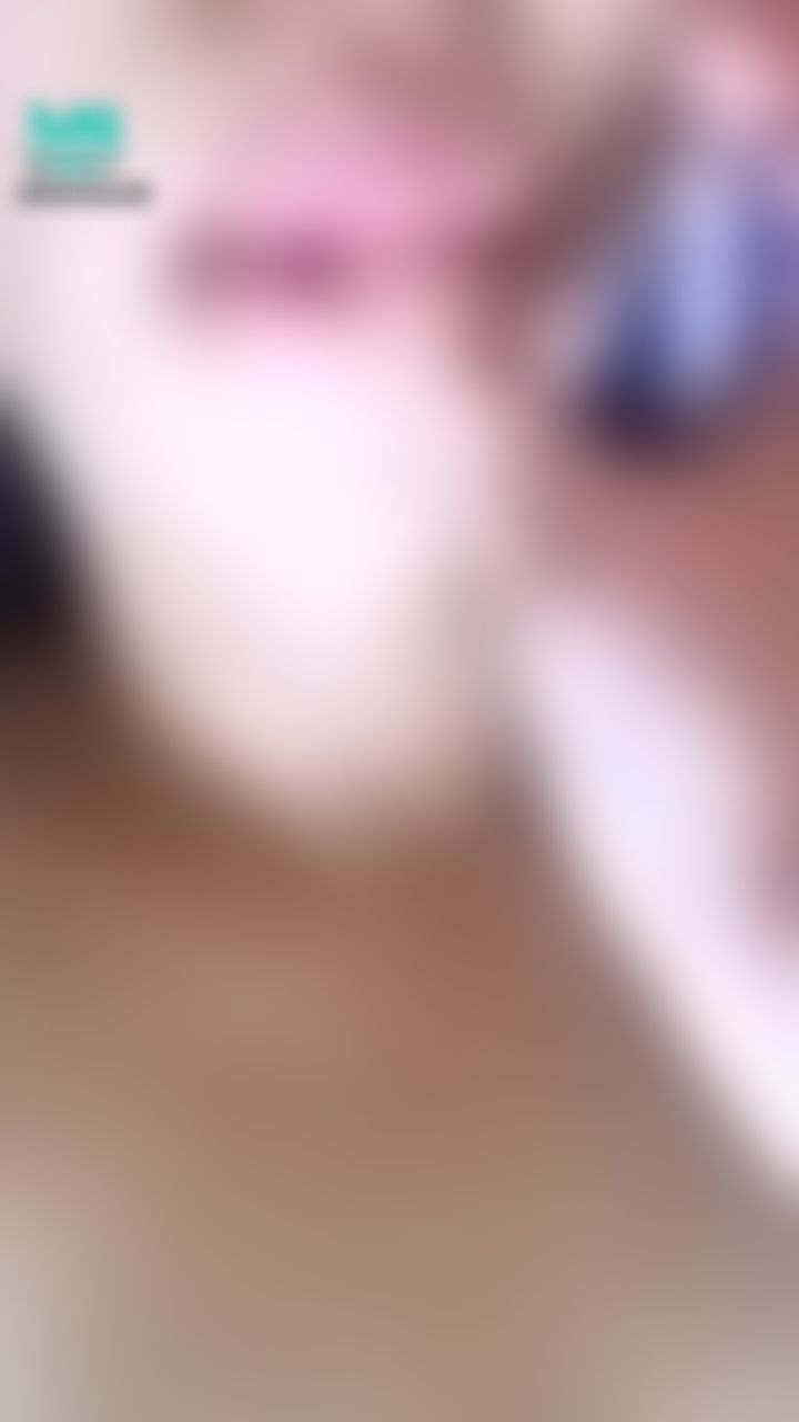  : 肥厚唇👄