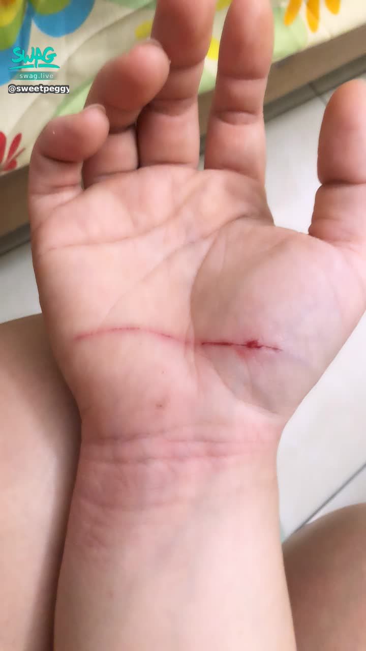  : Banban's hand was injured again
Shaking all over
hope no scars