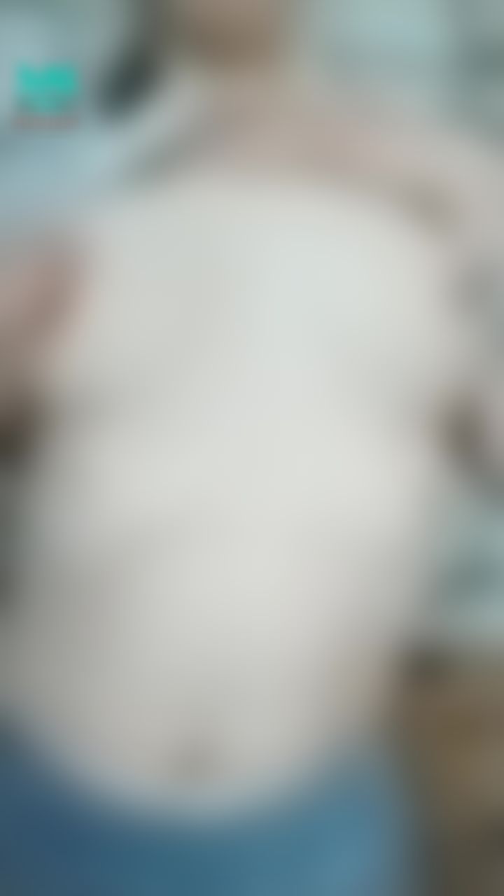  : 
