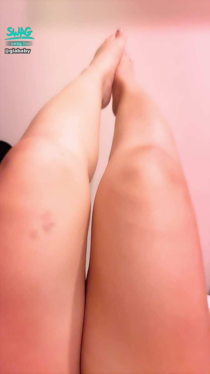  : I don't know why there is a bruise on my leg 🥺 Brother want to help Ya Ya Huhu?
