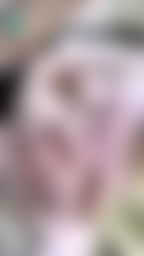 lynnbae : 你們還記得精緻小奶頭嘛🥺