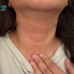 imluna : 哇 到處生病欸
又長濕疹了⋯
是不是因為睡眠一直不足😭